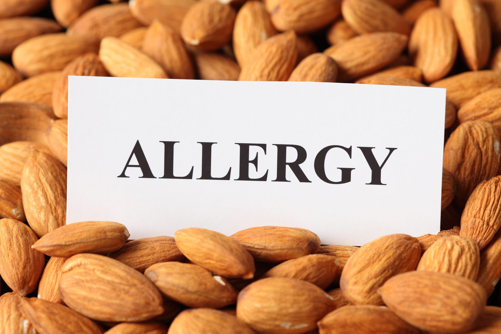 How long do nut allergy symptoms last